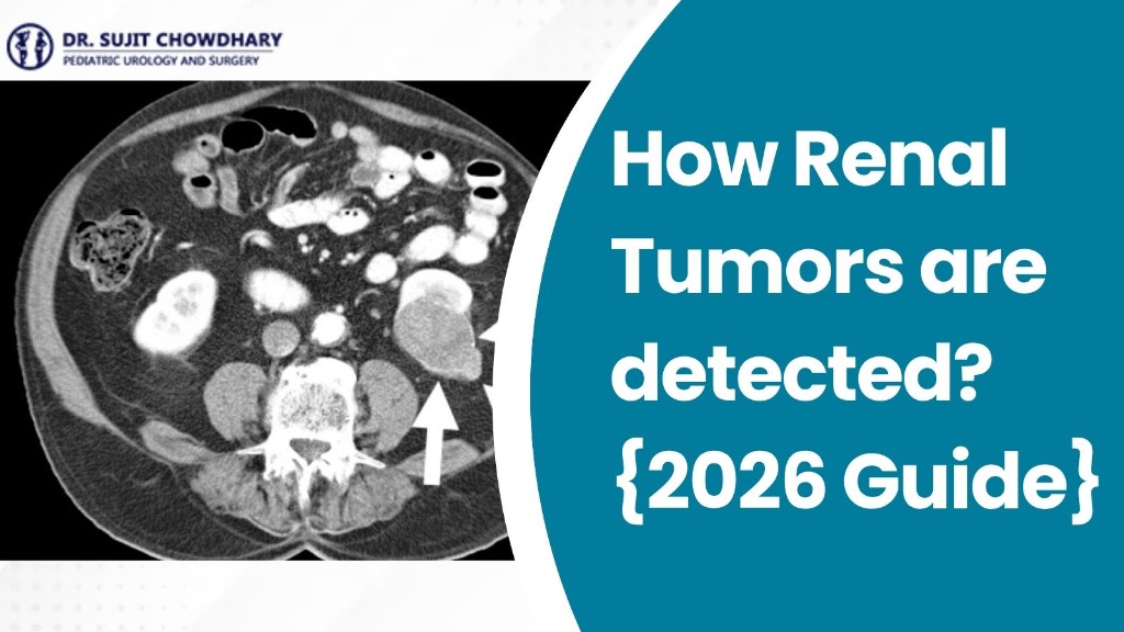 How Renal Tumors are detected? {2026 Guide} - Pediatric Kidney Tumor Diagnosis