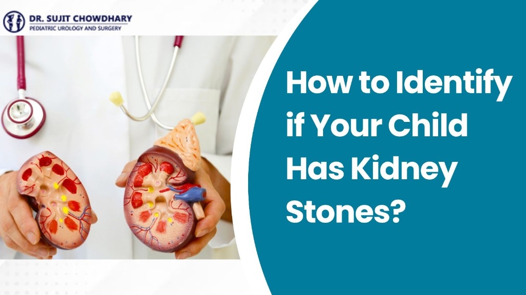 How to Identify if Your Child Has Kidney Stones? - Pediatric Kidney Stone Guide