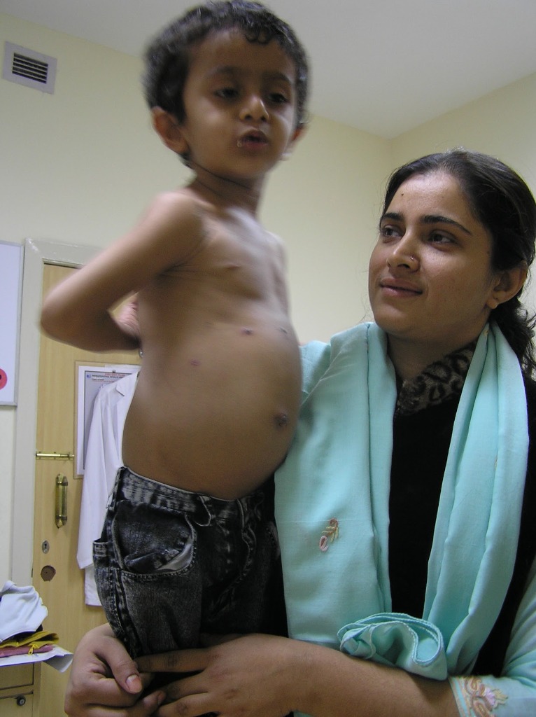 Patient Gallery Image 3